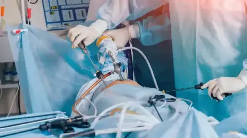 What is the Cost of Laparoscopic Surgery in Delhi?
